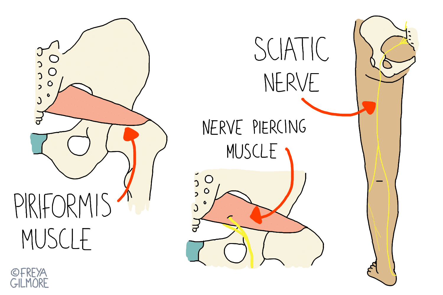 Piriformis Syndrome My MSK Clinic Burnley Manchester