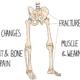 osteomalacia